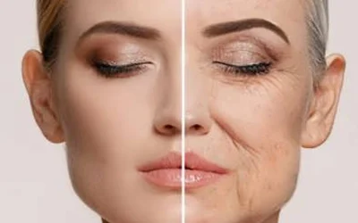 بهترین جراح لیفت صورت در اصفهان + نمونه کار