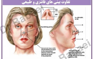 تفاوت بینی های فانتزی و طبیعی