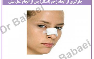 جلوگیری از ایجاد زخم پس از انجام عمل بینی