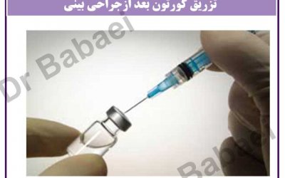 تزریق کورتون بعد ازجراحی بینی
