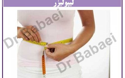 لاغری موضعی با لیپولیزر