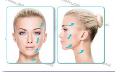 دکتر لیفت صورت با نخ در اصفهان