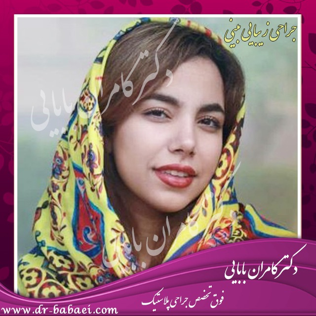 جراحی بینی گوشتی در اصفهان