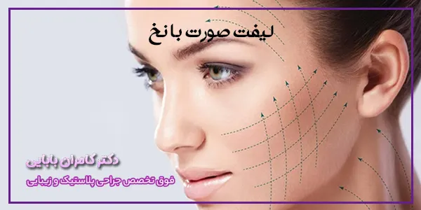 لیفت صورت با نخ