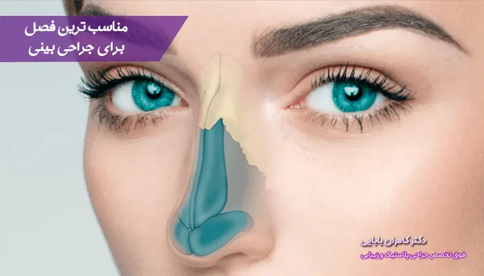 بهترین فصل برای جراحی بینی