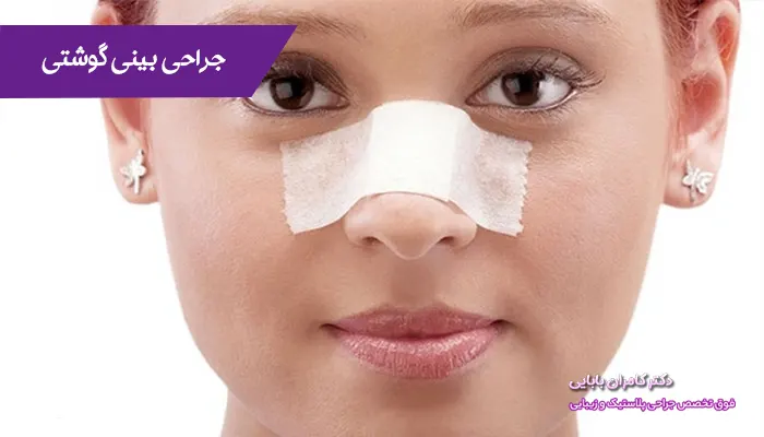 جراحی بینی گوشتی