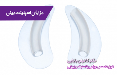 مزایای اسپلینت بینی