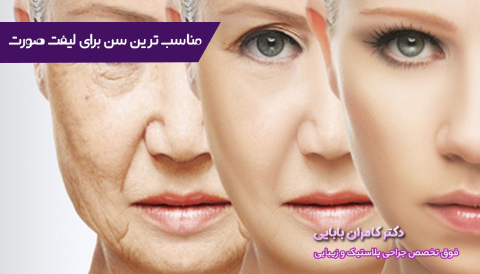 مناسب ترین سن برای لیفت صورت