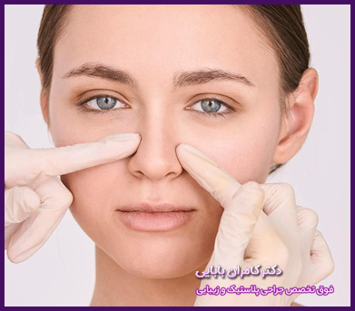 سایر نکات مراقبتی بعد از عمل بینی