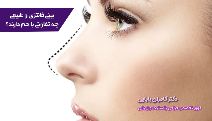 بینی فانتزی و طبیعی چه تفاوتی نسبت به هم دارند؟