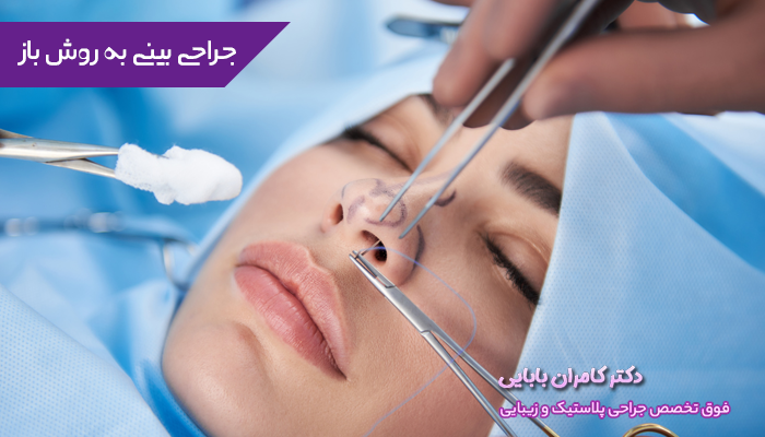 جراحی بینی به روش باز