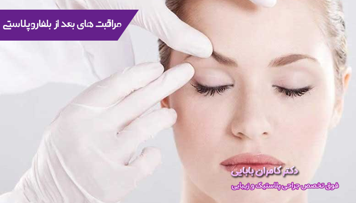 مراقبت های بعد از بلفاروپلاستی