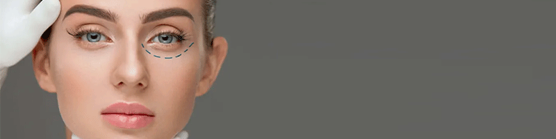 هزینه جراحی بلفاروپلاستی