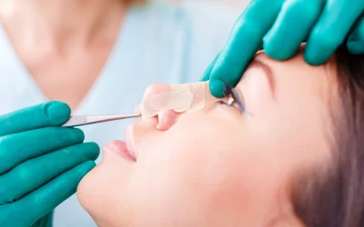 جراحی بینی استخوانی در اصفهان