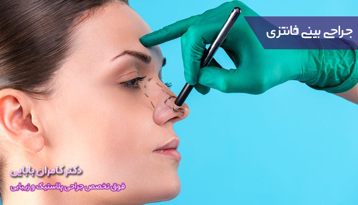 جراحی بینی فانتزی