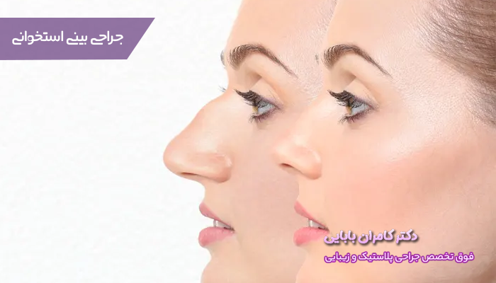 نکاتی که بعد از جراحی بینی استخوانی باید رعایت کنید